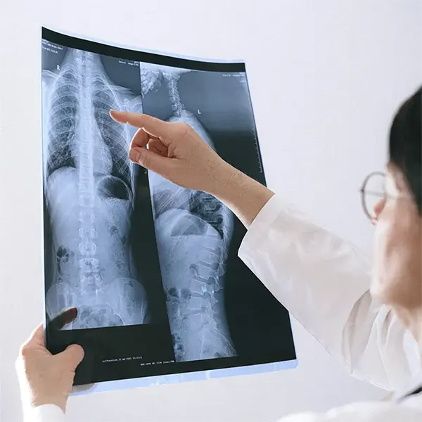 Scoliosis Treatment Near Me in East Greenwich, RI. Chiropractor For Scoliosis Pain Relief.