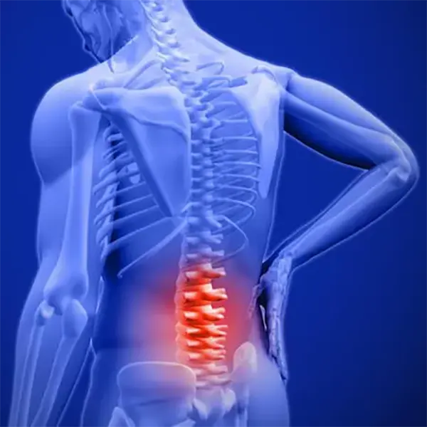 Spinal Decompression Therapy Treatment Near Me in East Greenwich, RI. Chiropractor For Decompression Pain Relief.